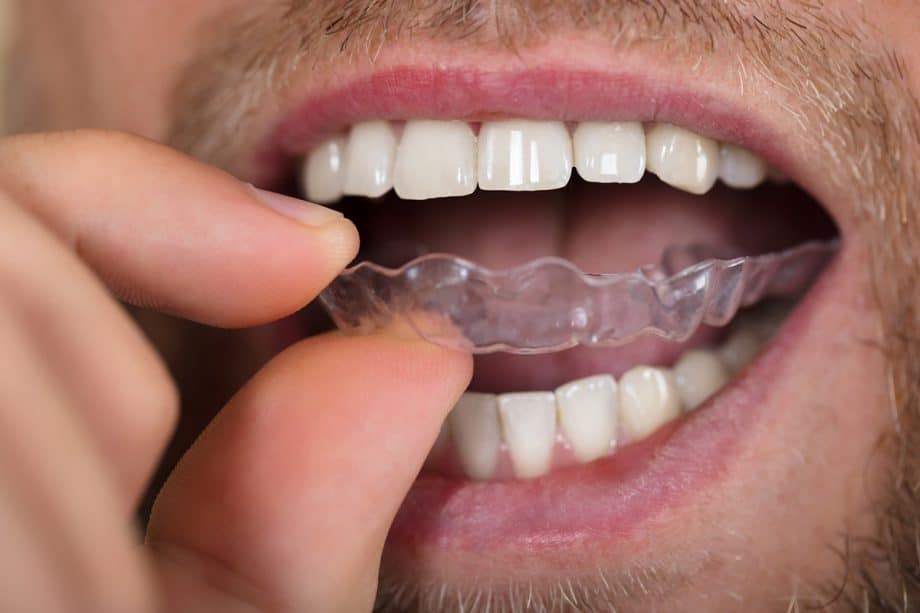 How Much Does Invisalign® Cost